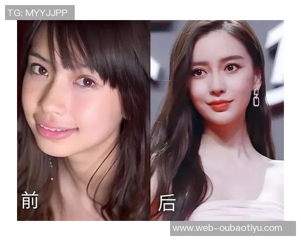 亚马尔自信分享戴牙套体验称其外观与自我形象完美契合